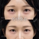 대전 눈썹정리 추천 1:1 맞춤 브로우컨설팅 받고 온 솔직후기