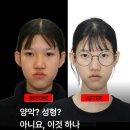 미소드림치과의원 | 턱교정기? 서울 강남 미소드림치과 황성식 생각