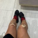 송도랜드마크정형외과의원 네이버블로그