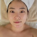 [강남피부관리] 콤마더문 강남 LDM 물방울 리프팅 관리 후기