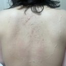 대동씨코아사우나(남) | 대전동구 피부관리샵, 등필링(등 여드름) &lt;보블랑 뷰티&gt;