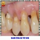 닥터손치과보철과의원 네이버블로그