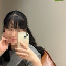 대구두피문신 플로우뷰티 SMP 정수리숱채움 일주일 후기 사진