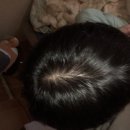 - | 비오틴영양제내돈내산 후기