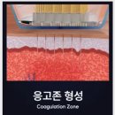 반포쇼팅타운 7동 앞 | 모공 레이저 가격? 버츄rf는 &#39;이것&#39;이 더 중요합니다
