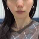 5731 | 티타늄리프팅 체험 후기 탄력 변화 솔직 리뷰 신사세레아의원