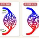 귀에서 심장소리 박동성 이명 원인 이미지