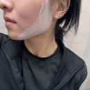 삼성서울리프앤톡스의원 | 강원 원주시 대상포진 전문병원 추천 | 무료접종 | 예방접종