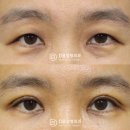 디비성형외과의원 이미지