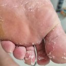 다이소 상품리뷰 | 필링을 부탁해 풋필링 마스크팩 여름대비 아기발만들기 솔직후기 내돈내산