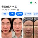 스킨라이프 | 용인 역북동 피부관리 골드스킨라이프 글로우리커버리 수분관리 후기