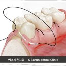 김포에이스치과의원 네이버블로그