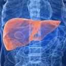 지방간의 진단과 관리 이미지