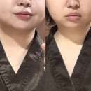 바디앤페이스 밸런스테라피(Body&Face) | [문래역/영등포구청역] 사운드바디사운드스킨 영등포...문래동피부관리·골드테라피 더블임팩트 후기