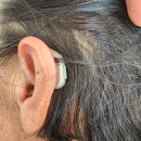 대동 독일보청기 이미지