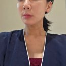 건강한피부나라 | 40대 리프팅추천! 요즘뜨는 초단파 피부 착붙 강남 올타이트리프팅 맞고 온 솔직후기