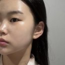 건대 피부관리 '달리아 에스테틱'에서 작은얼굴관리 받은 솔직후기