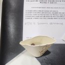 경대약국 | Ep40. 어금니&amp;사랑니 동시 발치, 경대치과대학병원, 발치후기