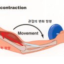 수축 이미지