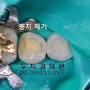 빛을보는치과의원 네이버블로그