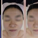대성식물병원 | 세종에스테틱 더블유에스테틱에서 하이온리프팅 10만줄 받은 찐후기!