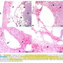 개와 고양이에서 emphysematous gastritis와 gastric emphysema에 감별 이미지