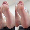 닥터페디&쭈네일 네이버블로그