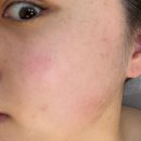 블랑스킨케어 | 광주 피부관리 추천, 스킨케어블랑에서 윤곽 수분관리 받고 온 솔직 후기