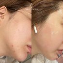 JY 메디칼 | [ 닥랩 연어앰플 ] 에스테틱 전용 스킨부스터 피디알엔 홈케어 캐럿라운지 리얼후기
