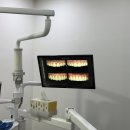 굿플랜치과의원 | 봉천동치과 라미네이트 상담｜그랑교정치과 무삭제 라미네이트 비니어 교정상담 후기