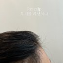 리스칼프