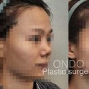 온도성형외과의원 네이버블로그