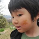 초록별숲유치원 Daum카페