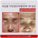 버닝헤드 이미지