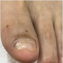 아우룸네일 이미지