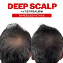 고령의원 | 고령 두피문신 광고말고 진짜 후기만 모았습니다