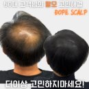 돕스칼프