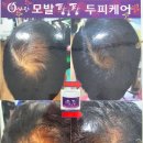 큐사랑반지