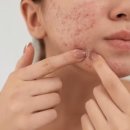 스칼렛스킨케어 이미지