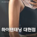 아이유안경 | 대구 북구 대현동 하이탠태닝 아이유 화이트 태닝 후기