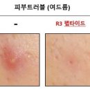 셀리버리 리빙앤헬스, &#39;R3 펩타이드&#39; 효과적인 인체적용시험결과 확인...&#39;피부트러블·안티에이징 효과&#39; 이미지