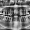 연세현치과의원 이미지