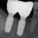 채움치과기공소 이미지