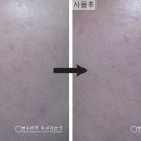 플로라안나 이미지