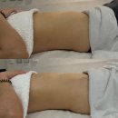 포항시남구29 | 포항 효자동 바디관리 남구 슬리밍 복부관리 후기