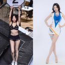 모델 강지영 님의 브이에스 의원 방문 후기