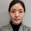 자임 | 40대 내돈내산 피부관리 5차, 듀엣고주파+포어자임 솔직후기