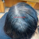 사상구에서왔다구요? 심한여성탈모 더이상방법이없다 부산르네시떼미용실탈모커버펌 전원일치 엄지척/ 괘법덕천화명명지모라구덕녹산용원김해울산양산밀 이미지