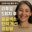 메리성형외과의원 | 리투오 5회차 후기 :: 안색이 밝아지고, 피부가 탱탱해지고, 잔주름이 사라진 이야기