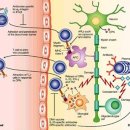 주작나무한의원 | [다발성경화증] 주작나무한의원에서 관리하세요
